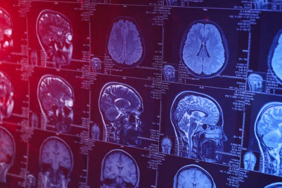 Neurolog otkrio što nikada ne radi kako bi očuvao zdravlje mozga